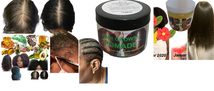 Wholesale-Hair Growth Pomade Grease- For Stronger, Thicker Longer Hair (pack 24) Organic Hair Solution, LLC