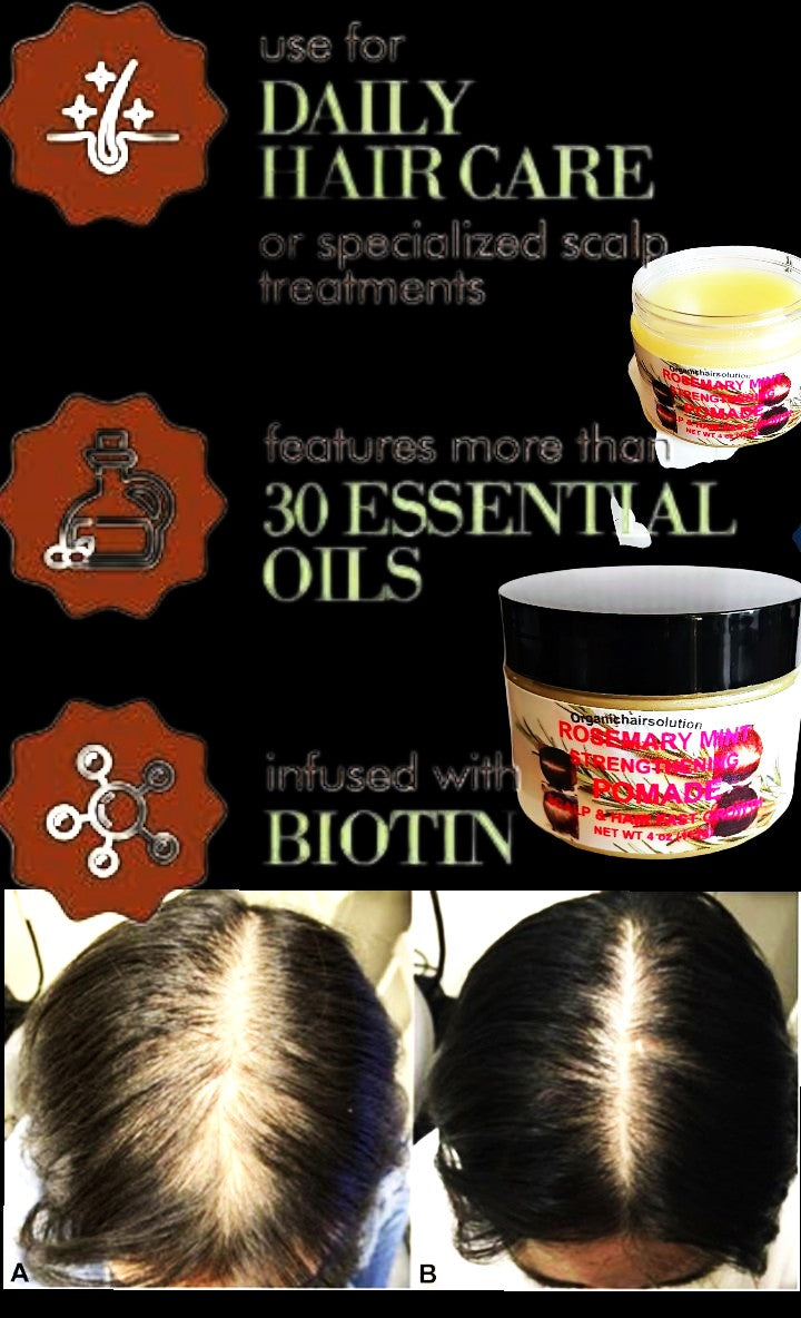 Wholesale-Organics Rosemary Mint Strengthening Hair Pomade, Grease-Scalp & Hair Treatment (24 pack) Organic Hair Solution, LLC