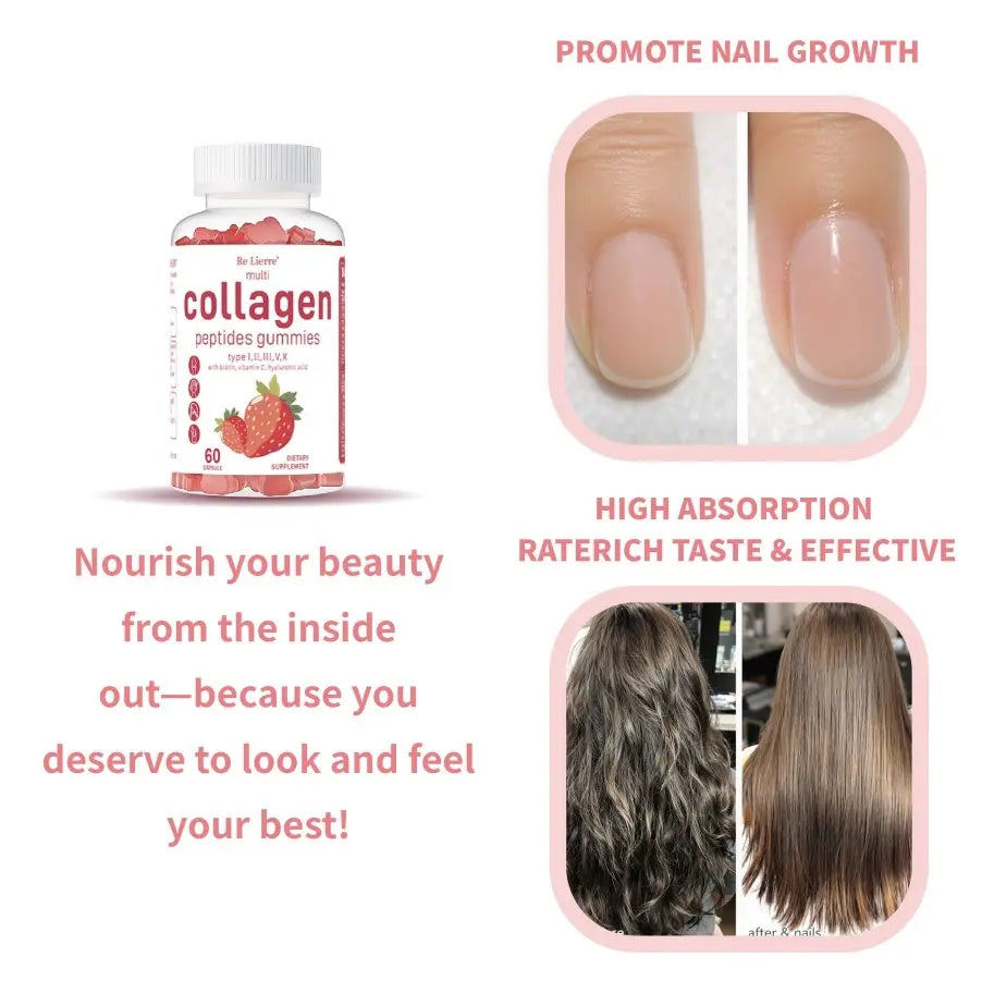 Collagen Peptide Gummies Roksy
