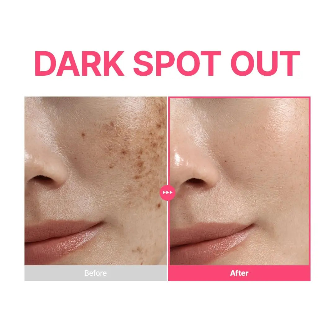PURITO TXA 6% + Niacinamide 10% + Retinal Facial Serum | for Dark Spots, Hyperpigmentation, Uneven Tone | High-Level Tranexamic Acid 6% | Korean skincare, 30mL 1.01 fl.oz 7DAY&