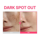 PURITO TXA 6% + Niacinamide 10% + Retinal Facial Serum | for Dark Spots, Hyperpigmentation, Uneven Tone | High-Level Tranexamic Acid 6% | Korean skincare, 30mL 1.01 fl.oz 7DAY&
