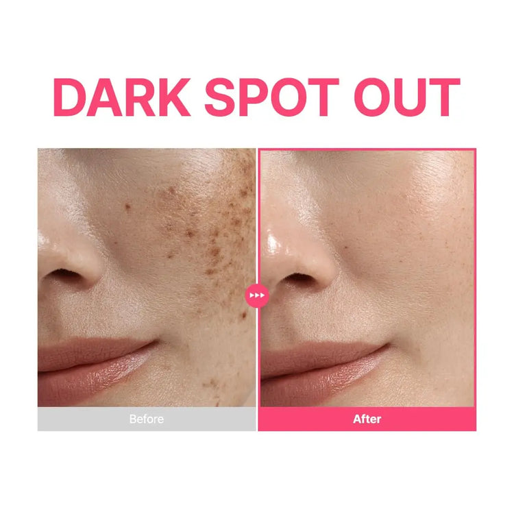 PURITO TXA 6% + Niacinamide 10% + Retinal Facial Serum | for Dark Spots, Hyperpigmentation, Uneven Tone | High-Level Tranexamic Acid 6% | Korean skincare, 30mL 1.01 fl.oz 7DAY&