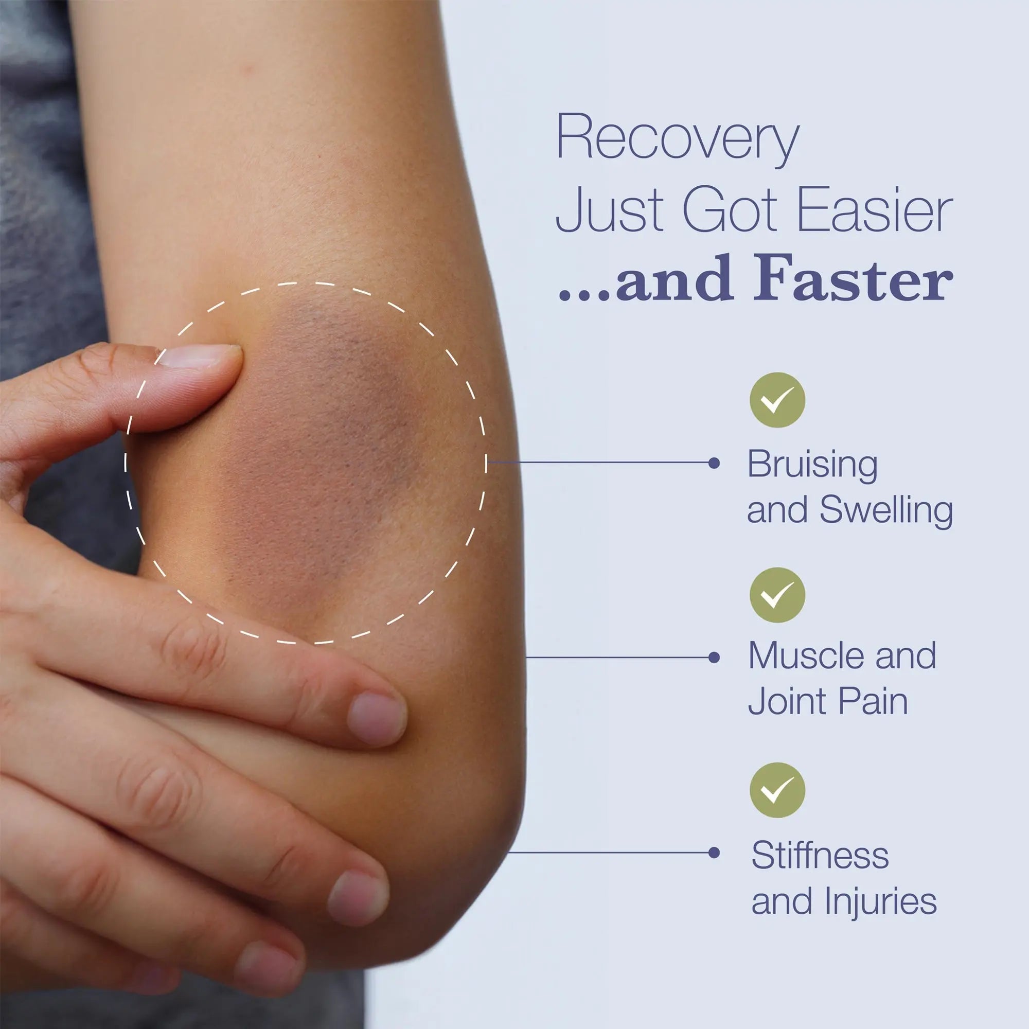 BruiseMD Arnica & Bromelain Capsules – Bruise & Swelling Relief Bruise-MD