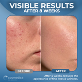 Hyaluronic Acid +Vitamin B5 Serum Cosmedica Skincare