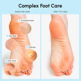 Exfoliating & Hydrating Foot Mask Maree