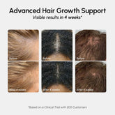 4-in-1 Hair Growth Spray Maree