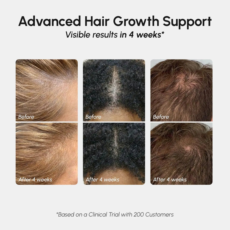 4-in-1 Hair Growth Spray Maree