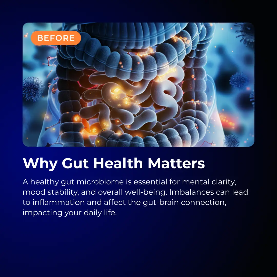 Neuro Probiotic by RevitMe RevitMe - Supplements Store