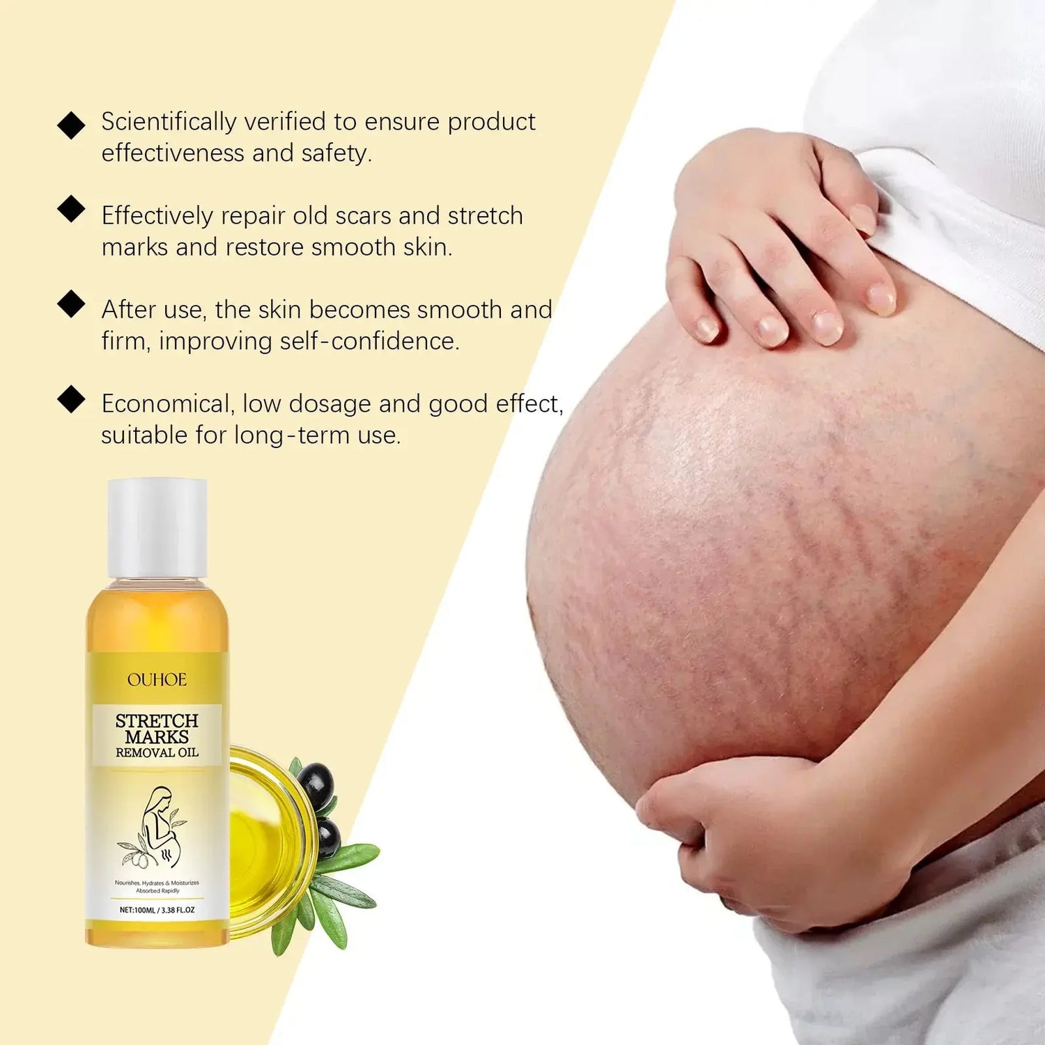 Stretch Mark Lightening Essential Oil Skin Care Cream for Pregnant Women Moisturizing Lifting Firming Skin Slimming Oil 100ml Roksy