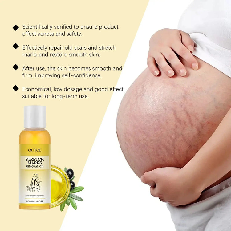Stretch Mark Lightening Essential Oil Skin Care Cream for Pregnant Women Moisturizing Lifting Firming Skin Slimming Oil 100ml Roksy