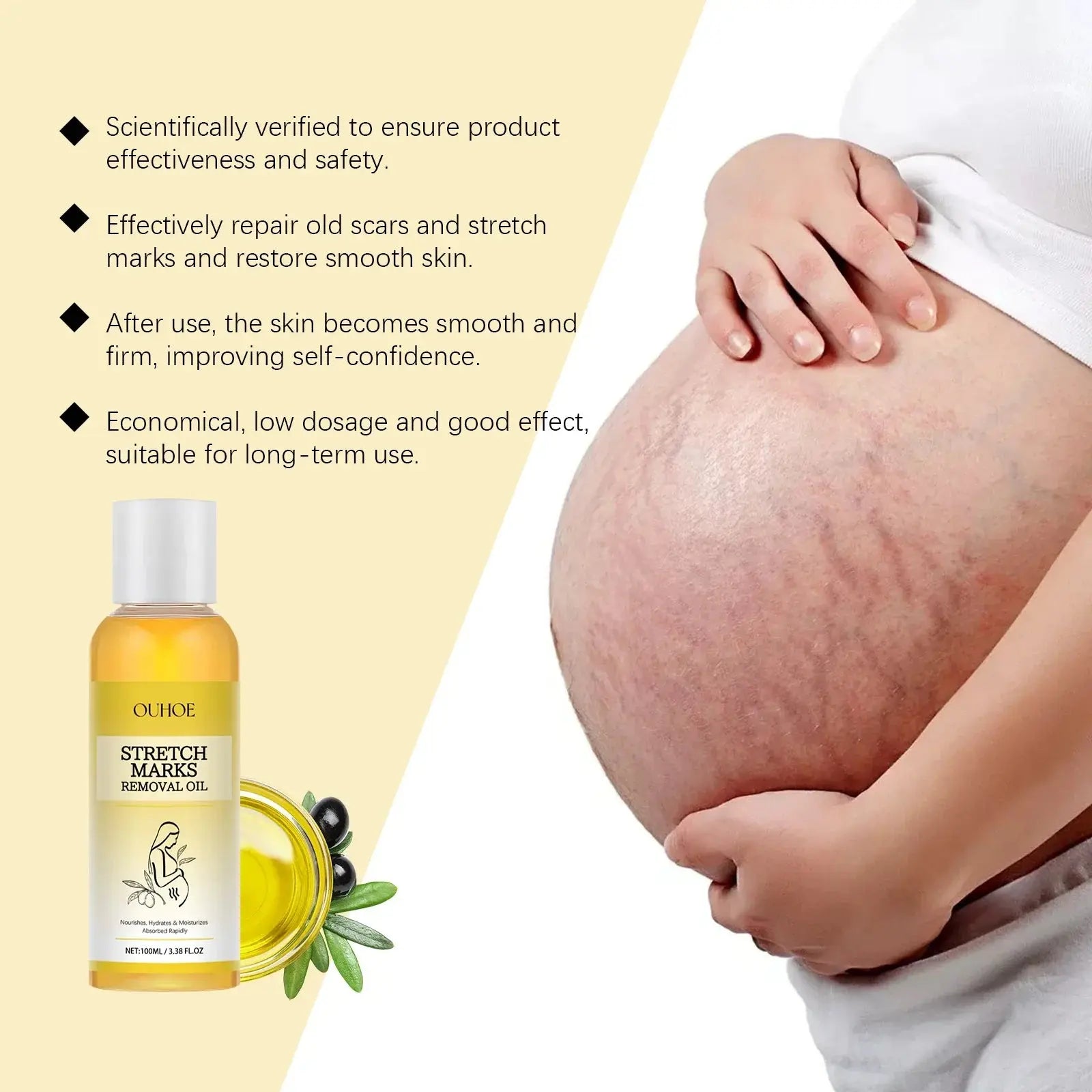Stretch Mark Lightening Essential Oil Skin Care Cream for Pregnant Women Moisturizing Lifting Firming Skin Slimming Oil 100ml Roksy