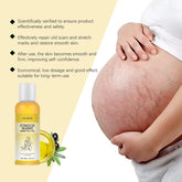 Stretch Mark Lightening Essential Oil Skin Care Cream for Pregnant Women Moisturizing Lifting Firming Skin Slimming Oil 100ml Roksy