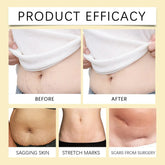 Stretch Mark Lightening Essential Oil Skin Care Cream for Pregnant Women Moisturizing Lifting Firming Skin Slimming Oil 100ml Roksy