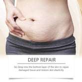 Stretch Mark Lightening Essential Oil Skin Care Cream for Pregnant Women Moisturizing Lifting Firming Skin Slimming Oil 100ml Roksy