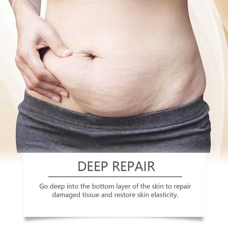 Stretch Mark Lightening Essential Oil Skin Care Cream for Pregnant Women Moisturizing Lifting Firming Skin Slimming Oil 100ml Roksy