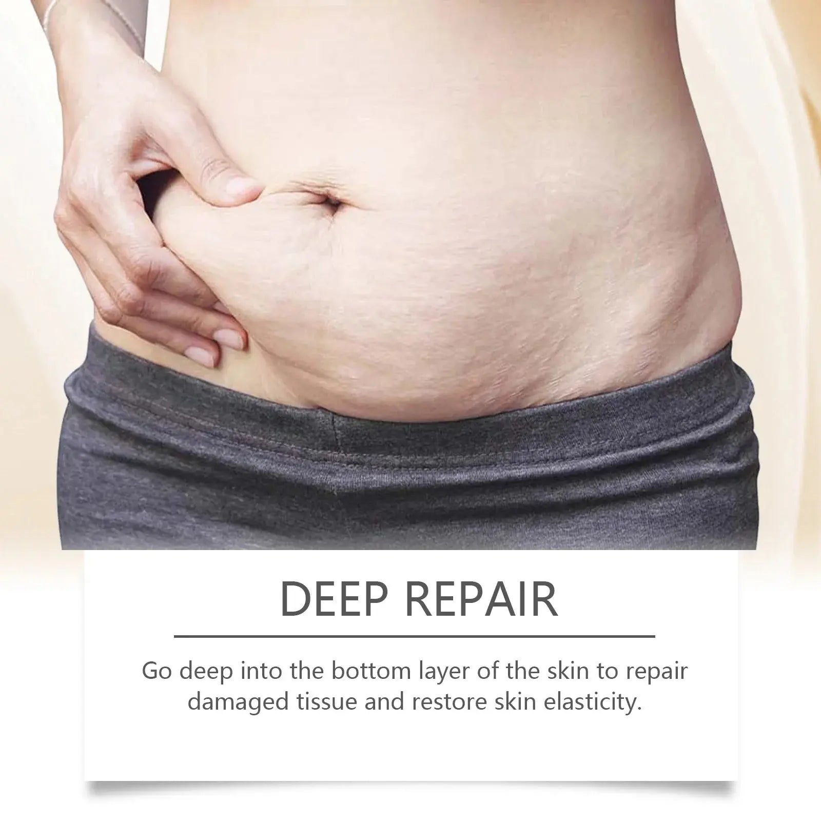 Stretch Mark Lightening Essential Oil Skin Care Cream for Pregnant Women Moisturizing Lifting Firming Skin Slimming Oil 100ml Roksy