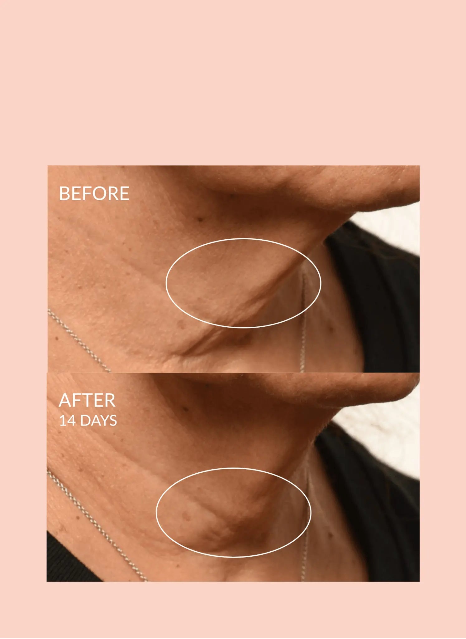Theorem Serum Boost Caire Beauty
