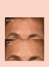 Triple Lift Molecule Mask Caire Beauty