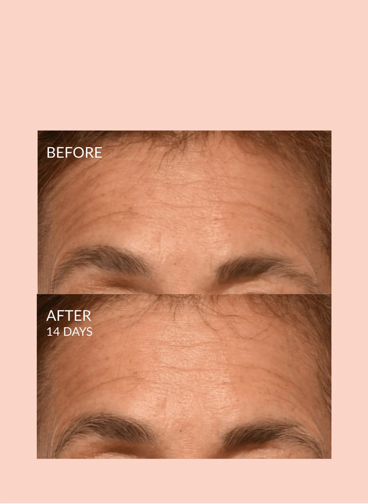 Triple Lift Molecule Mask Caire Beauty